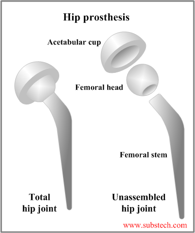 hip_prosthesis.png